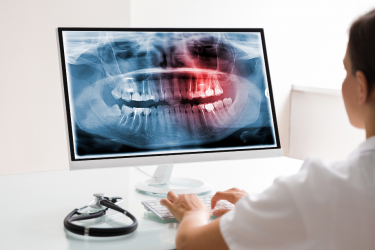 Los 5 mejores programas de gestión para clínicas dentales